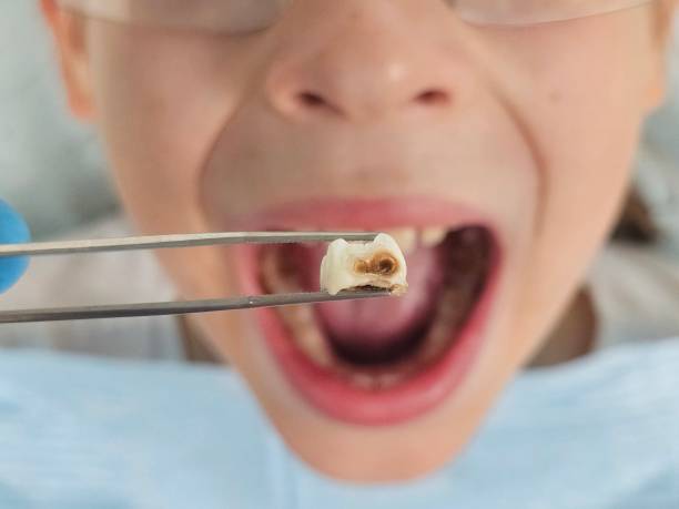 Best Weekend Emergency Dentist in Cross City, FL